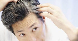 پیری و تاثیر آن بر رشد مو و طاسی سر در افراد و روش های مراقبت از مو