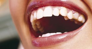 معرفی چند راه که به کمک آنها دندان هایی زیبا و سفیدتر خواهید داشت