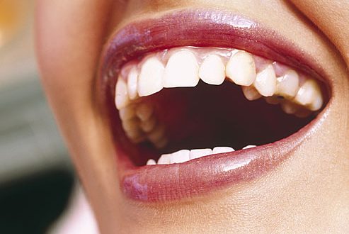 معرفی چند راه که به کمک آنها دندان هایی زیبا و سفیدتر خواهید داشت
