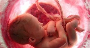 آیا پیشگیری از بارداری طبیعی موجب نازایی در آینده می شود؟